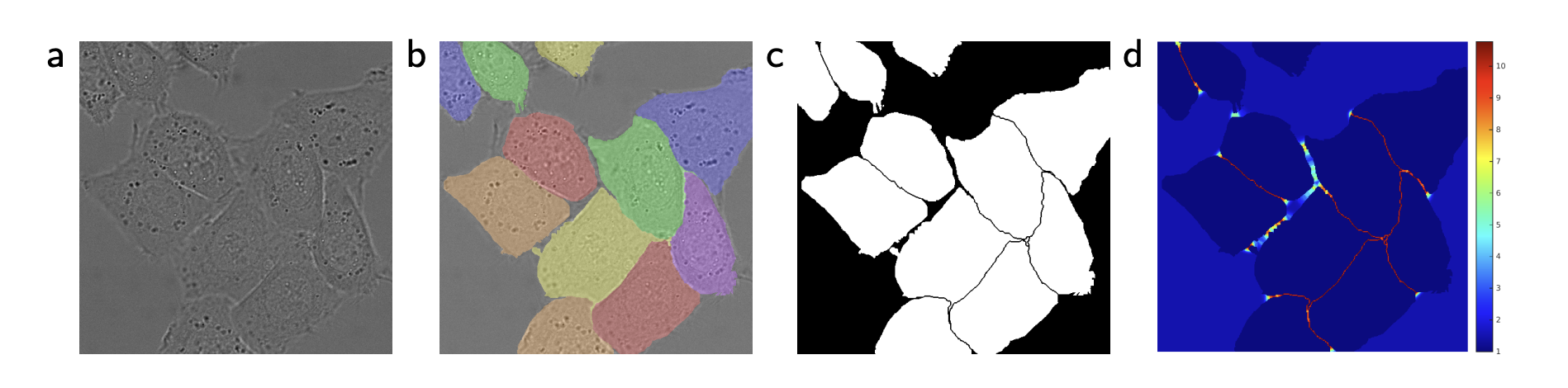 HeLa cell segmentation